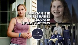 Jeanna Giese, first rabies survivor after symptoms